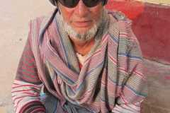 Cataract Operation