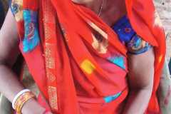 Cataract Operation